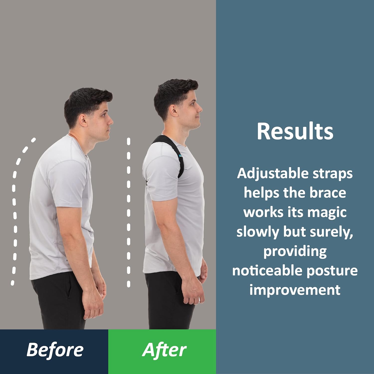 ComfyBrace Posture Corrector Back Brace for Men and Women Adjustable