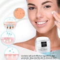 Dark Spot Remover for Face and Body: Hyperpigmentation Treatment - Natural Ingredient - Freckle/Melasma/Sun Spot/Age Spot Remover - Dark Spot Corrector Cream for Women and Men