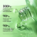 Anua Azelaic Acid 10 Hyaluron Redness Soothing Serum, Facial Serum for Sensitive skin, Hyaluronic Acid, Niacinamide, Spot Care, Natural Color, Vegan, Korean Skincare (30ml/ 1.01 fl oz.)