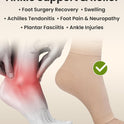 KEMFORD Ankle Compression Sleeve - 20-30mmHg, Beige, M